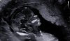 ETSEO_0011.JPG
