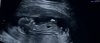 6370E952-9045-4CE6-9B8E-9DF6EA2C7F1E.jpeg