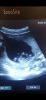 E4EBB15C-F2F2-430B-8735-7D2A445ED4AB.png