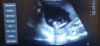 CAD09D16-CB86-4415-9EDF-D347E8DD5A16.png