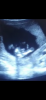 566994AA-F889-4719-95D5-67789A3DDA9F.png
