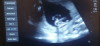 FCEBDA7C-9DC7-4613-809B-F0B004F9B45C.png