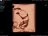 Baby 14 weken (3).jpg