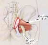 heup-piriformis-.jpg