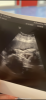 D34DF9A2-B1C2-4B77-8B47-2DE70A5F9369.png