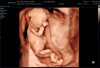 15 WK ECHO_0009.jpg