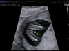 15 WK ECHO_0005.jpg