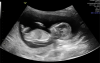 Screenshot_20221108-123512.png