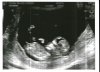 Baby2nub.jpg