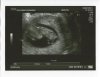 echo 4-7-2013.jpg