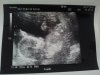 14w6d.jpg