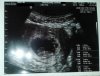 echo9wk.jpg