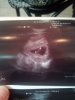 Baby 6 weken 6 dagen.jpg