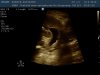 Baby6.jpg