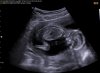 BABY4D_0001.jpg
