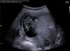 BABY4D_0002.jpg
