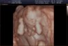 BABY4D_0021.jpg