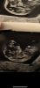 B9E0C2EC-599A-40F6-8045-A9D324A217A5.png