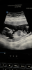 59B866C2-3DE5-4D68-B15B-B4EAABE60555.png