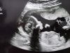 20221129_084301.jpg