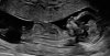 Screenshot_20221130_142618.jpg