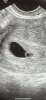 0AE9819D-4E22-4E77-976C-32147BC51A27.png