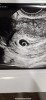 181DFEEF-84AB-4115-8F19-3F39FA173748.png