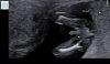 C7C9179C-6759-4F00-97D4-105B22F80477.jpeg