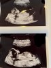 Baby echo 13w4-.jpg