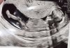 5F36CBB8-ECEC-4E76-B6B1-16E430591805.jpeg