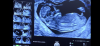 539E6CC9-CEC5-429C-9440-A194AE56EE02.png