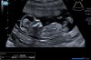 D4F75378-6871-4C92-B05E-2B4A6E374917.jpeg