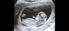 3412A49B-E6C7-4F2B-87D4-A62879BEBABE.png