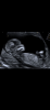 A82690D0-D559-430B-AFF8-BC3DE5E41C04.png
