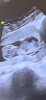 FF47DFFC-6906-4910-979E-24531389981B.png