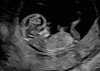 thumbnail_IMG_7102.jpg