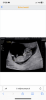 17F20130-43E3-46EF-9D3A-32F2F40BCFE8.png