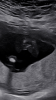 520A43DF-EBD4-45AA-86F3-3E0D6AFCAEDC.png