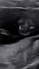 64BB5E2E-ADB0-4611-A65B-F9AF8B4BF53E.png