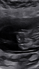 EE35342F-F7A5-4DB9-931C-47E31F4EBC83.png
