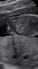 F510DDBD-3F87-45B8-ABB4-F5AECEA7185C.png