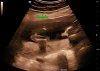 thumbnail_202305130939440058OB.jpg