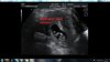 babyechofotovb2.jpg
