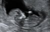 BABYECHOanderserom.jpg