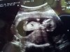 baby 2 echo 14 weken.jpg