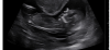 D431C7EC-BC8A-442E-9A57-9D300665BC3E.png
