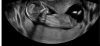 E0F37D4B-5850-4570-9881-F54981112B91.png