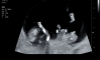 Scherm­afbeelding 2023-05-25 om 10.34.19.png