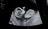 Scherm­afbeelding 2023-05-25 om 10.33.50.png
