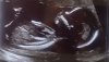 62D8C023-89DC-4BBD-B6FB-698FABEC82C7.jpeg